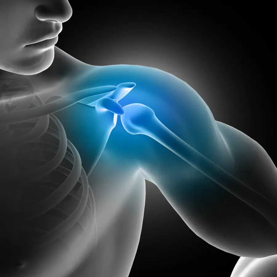 Illustration of a shoulder and upper back highlighted to show an area of injury